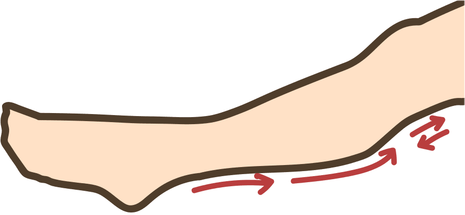 5点ローラー・拡大